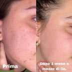 Lia - La crema viso su misura per la tua pelle (50ml)