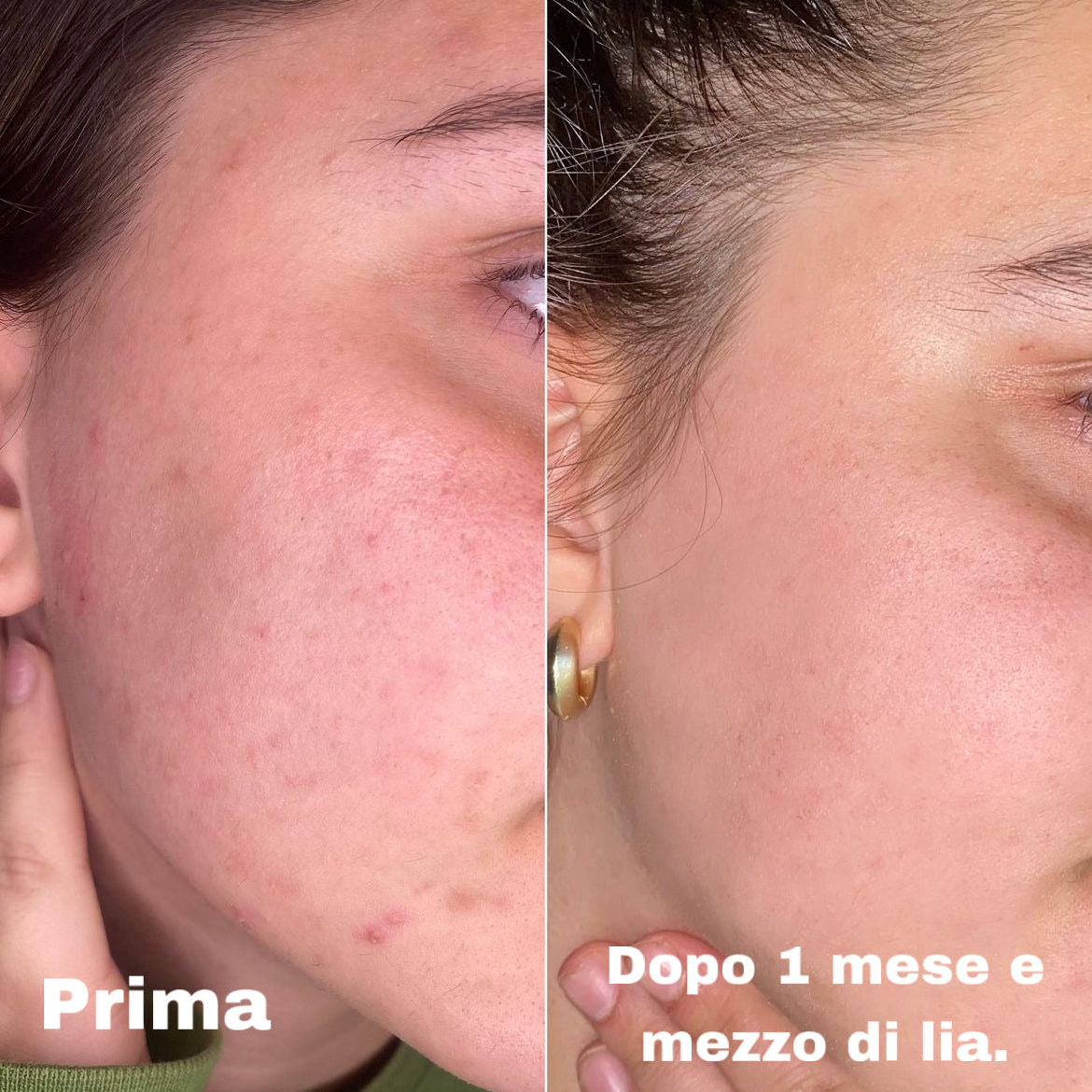 Lia - La crema viso su misura per la tua pelle (50ml)