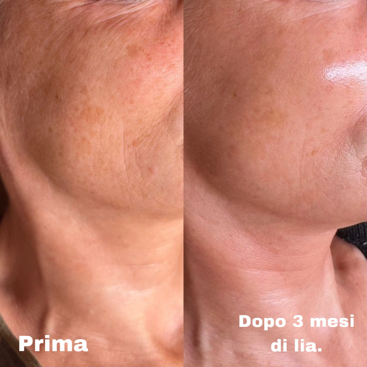 Lia - La crema viso su misura per la tua pelle (50ml)