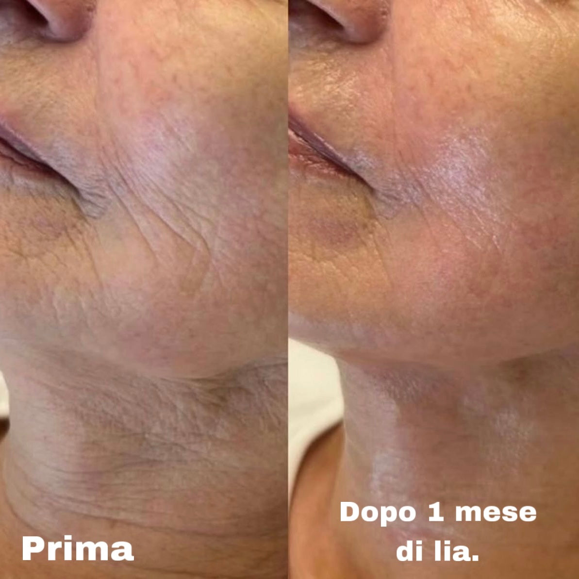 Lia - La crema viso su misura per la tua pelle (50ml)