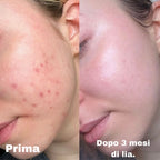 Lia - La crema viso su misura per la tua pelle (50ml)
