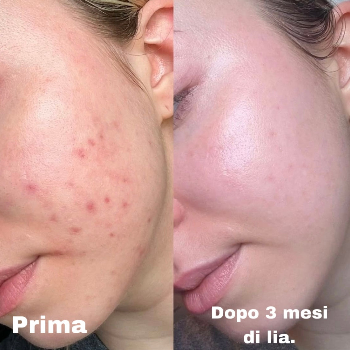 Lia - La crema viso su misura per la tua pelle (50ml)